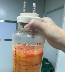 陵水水动力吸脂手术要做多久？